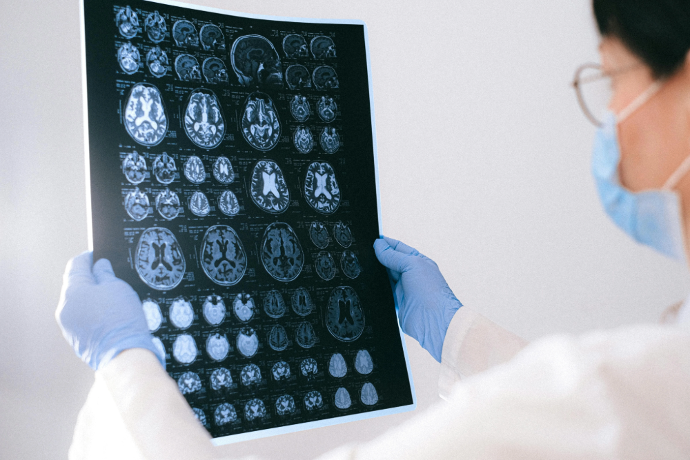 Reflexologie Alzheimer